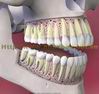 Giải phẫu tổng thể răng và hàm răng